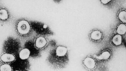 ¿Puede la obesidad aumentar los riesgos del coronavirus?