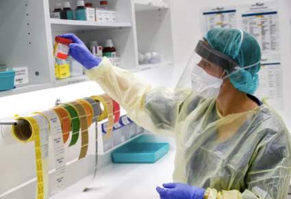 COVID-19: ¿Puede el coronavirus causar un derrame cerebral? ¿Cuáles son los síntomas?