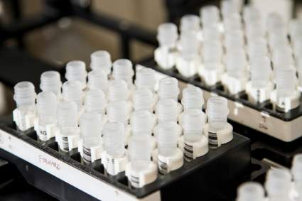 FDA autoriza primera prueba casera para el COVID-19. ¿Cuándo estará disponible?