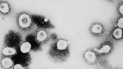 Muertes por coronavirus por cada 100,000 en los EE. UU. Frente a otros países