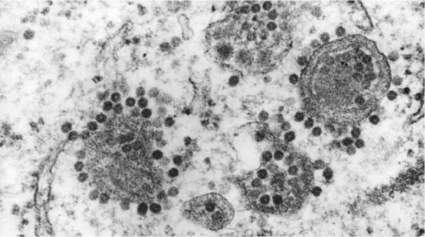 ¿Preocupado por el virus transmitido por mosquitos, “EEE”? ¡Entérate cómo evitarlo!