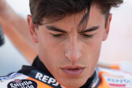 Marc Márquez mostró cómo le quedó el brazo tras el accidente y consternó a sus seguidores: ¿era necesaria la foto?