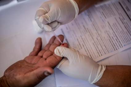 40 años después del primer reporte de VIH/SIDA: ¿Cómo está el virus en EE.UU?