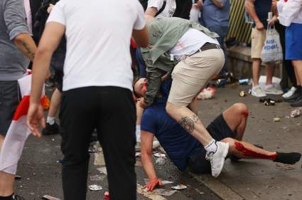 Violencia en la Euro 2020: Hooligans ingleses emboscaron a italianos: [VIDEO]