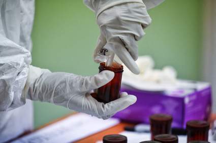 Alerta por síntomas de nueva enfermedad en EE.UU. que ya causó muertes: Melioidosis