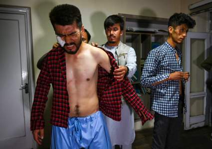 Talibanes golpean brutalmente a dos periodistas: ¿Cómo quedaron? – Fotos y Video