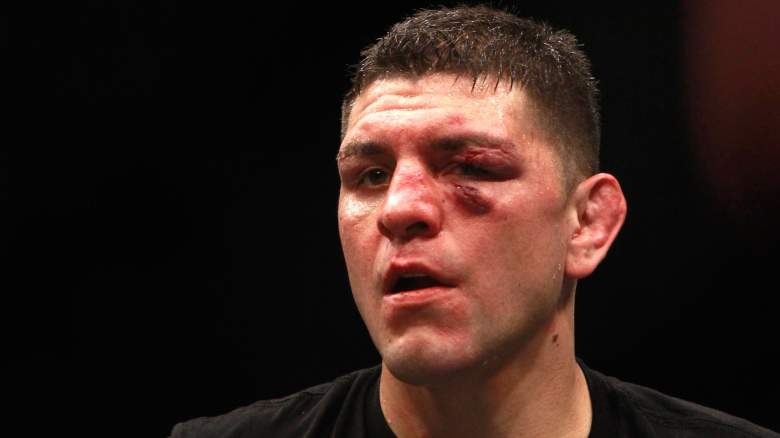 Nick Diaz regresa en UFC 266.