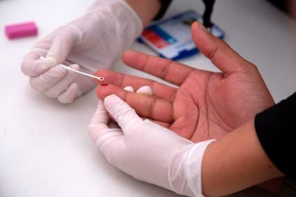 Una mujer se habría curado del HIV por inmunidad natural