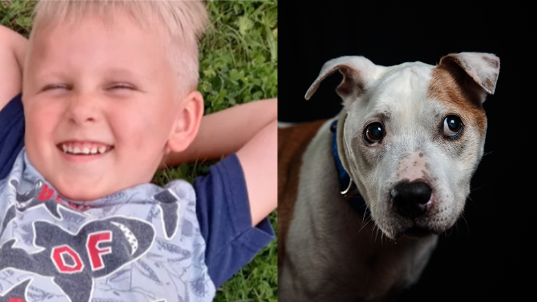 Niño de 4 años pierde un brazo tras ataque de una pitbull: Axel Foster