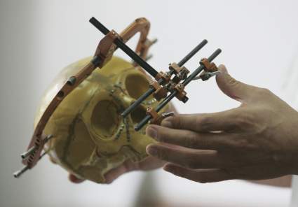 Descubren nueva parte del cuerpo humano situada en la mandíbula: ¿Para qué sirve?