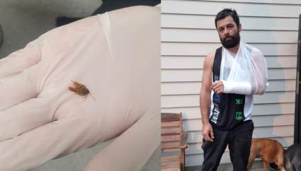 Cucaracha habitó por días dentro del oído de un hombre ¿Qué daños le provocó?