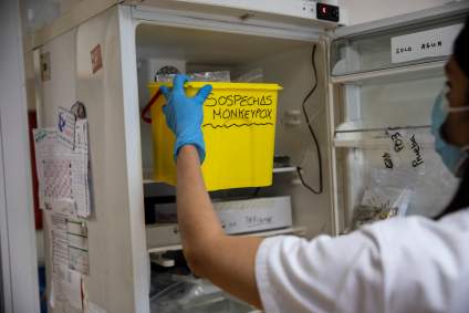 Viruela del mono: Preocupa su avance en todo el mundo: ¿Cuántos casos confirmó la OMS?