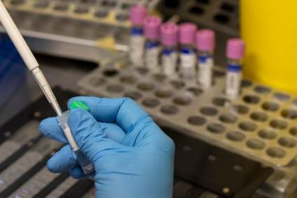 Viruela del mono: OMS anuncia drástica medida para frenar el brote mundial