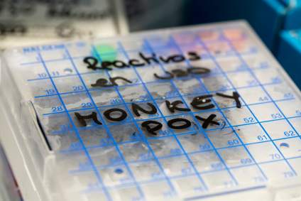 ¿La viruela del mono se transmite con los besos?: Entérate que revelaron los CDC