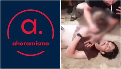Florida: Caimán gigante ataca a joven y le amputan un brazo – VIDEO