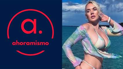 Amputan pierna a modelo estadounidense tras infección bacteriana