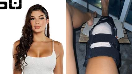 Ana Parra se recupera de su cirgua de rodilla [VIDEO]