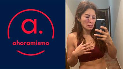 La atleta Daniela López acusa de violencia a su expareja [IMÁGENES FUERTES]