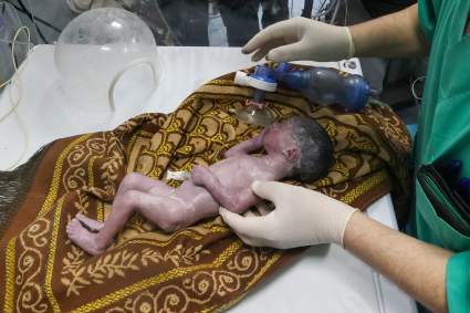 Muere la bebé rescatada del vientre de su madre muerta en Gaza