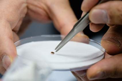 Bacterias, hongos y ácaros: nuestros diminutos compañeros de cama