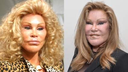 Murió Jocelyn Wildenstein: ¿De qué murió la ‘mujer gato’?